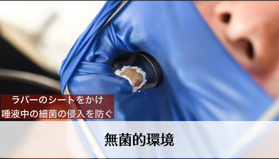 ラバーダム防湿