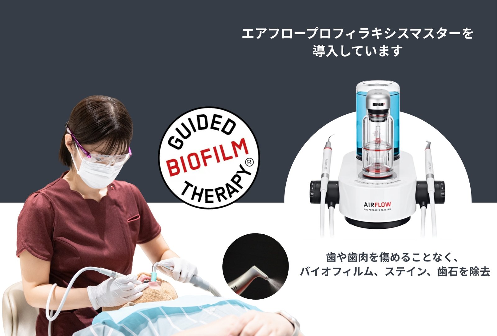 エアフロー プロフィラキシスマスターによるクリーニング