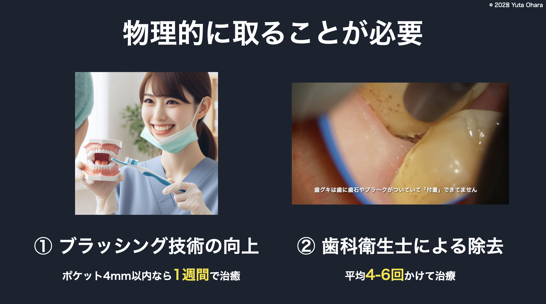 基本治療（歯科衛生士と患者さんの協力）