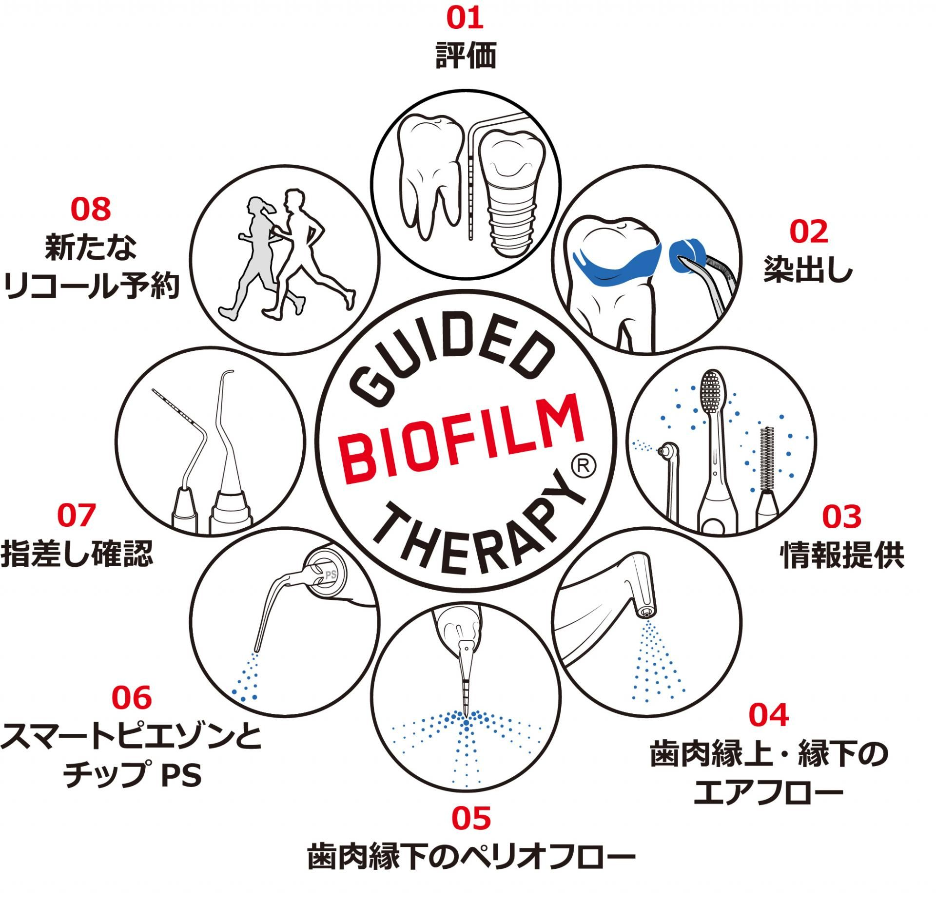 GBT手順イメージ