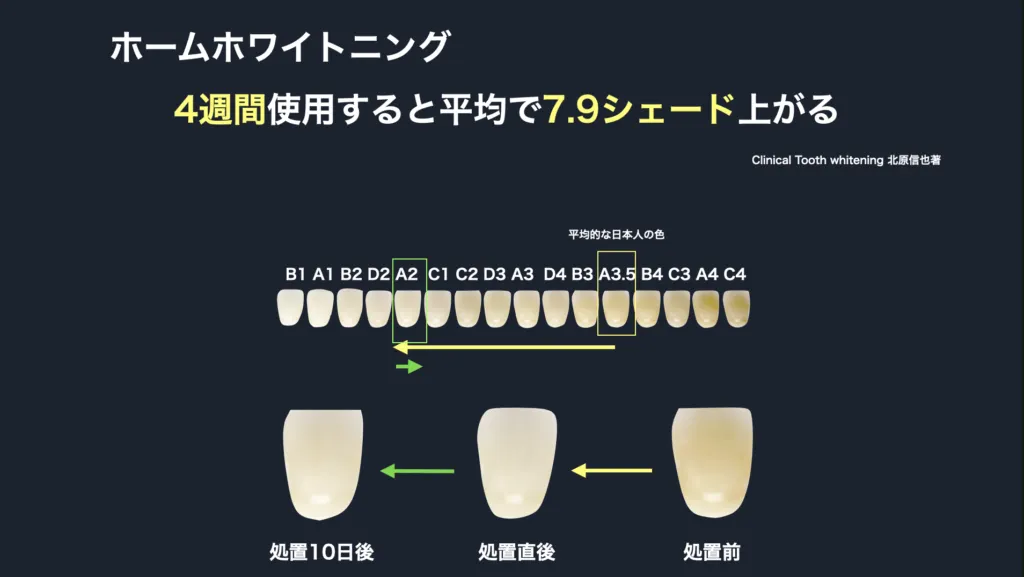 ホームホワイトニング2